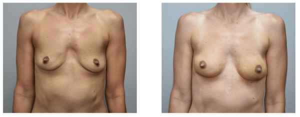 Image may contain Arm Body Part Person Knee and Adult